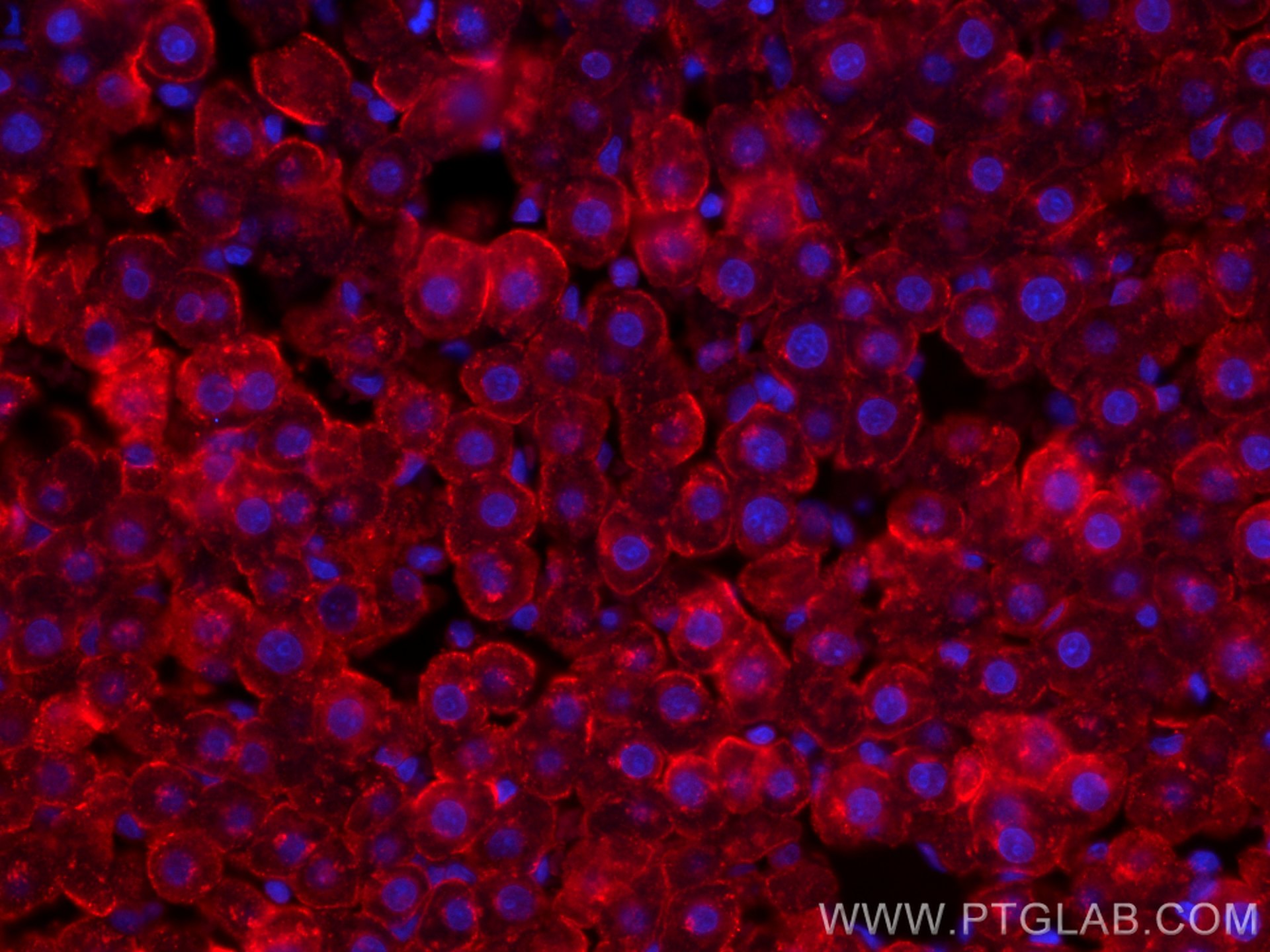IF Staining of rat liver using CL594-11739