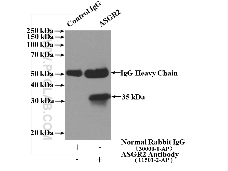 IP experiment of L02 using 11501-2-AP