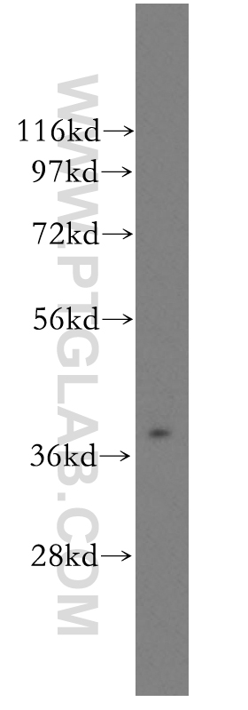 ASGR2 Polyclonal antibody