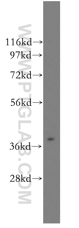 WB analysis of human liver using 11501-2-AP