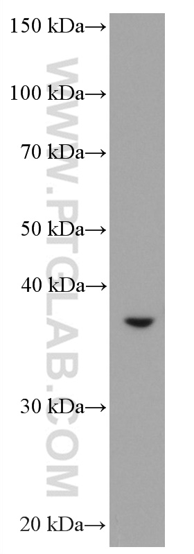 WB analysis of SMMC-7721 using 66831-1-Ig