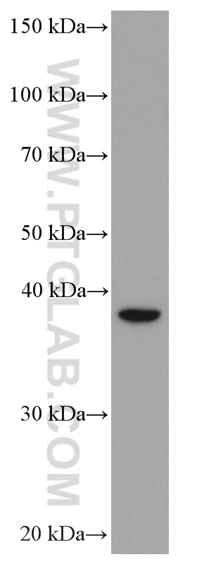 ASGR2