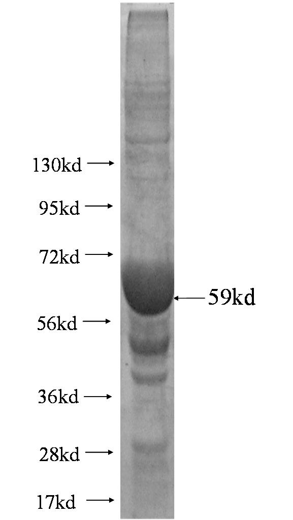 ASH2L fusion protein Ag3008 SDS-PAGE