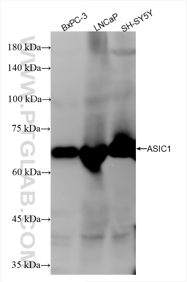 WB analysis using 85089-1-RR (same clone as 85089-1-PBS)