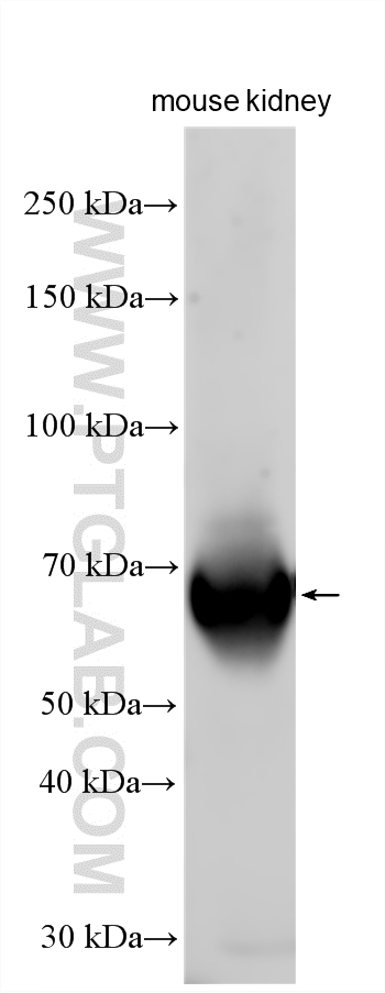 Mouse kidney tissue lysate was subjected to SDS PAGE followed by western blot with 28093-1-AP (ASIC3 antibody) at dilution of 1:1000 incubated at room temperature for 1.5 hours. WB analysis using 28093-1-AP