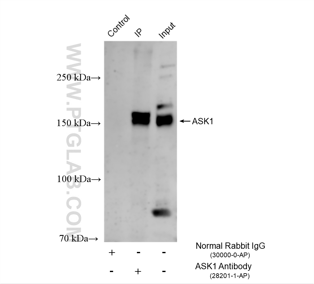 IP result of anti-ASK1 (IP:28201-1-AP, 4ug; Detection:28201-1-AP 1:1000) with HeLa cells lysate 1280 ug. IP experiment of HeLa using 28201-1-AP