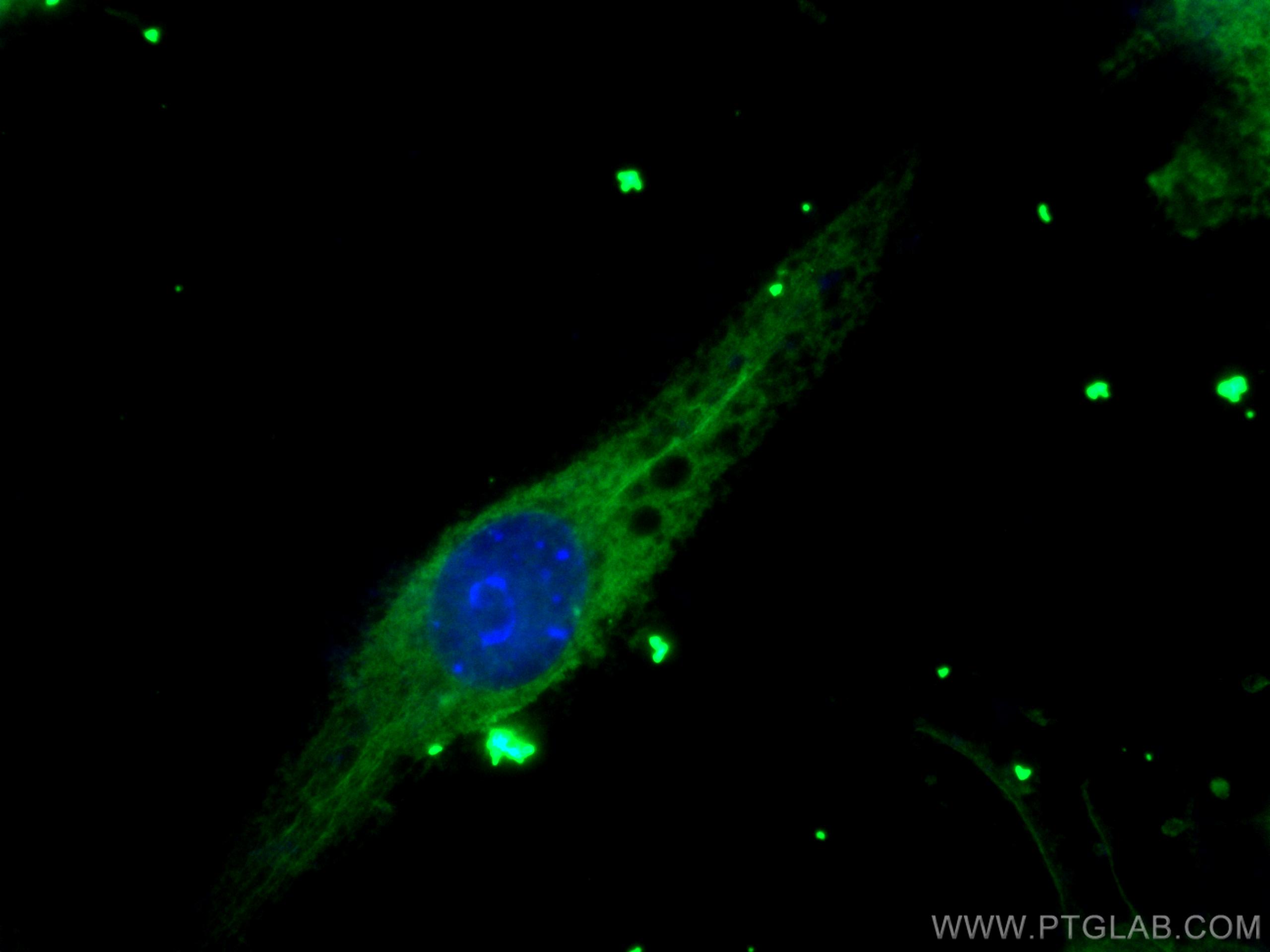 IF Staining of RAW 264.7 using 67072-1-Ig (same clone as 67072-1-PBS)