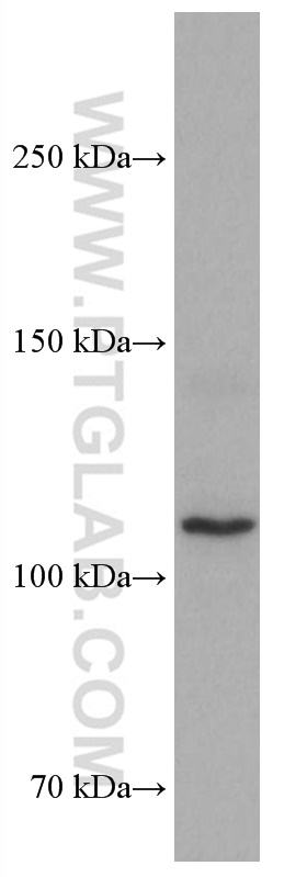 WB analysis of HSC-T6 using 67072-1-Ig