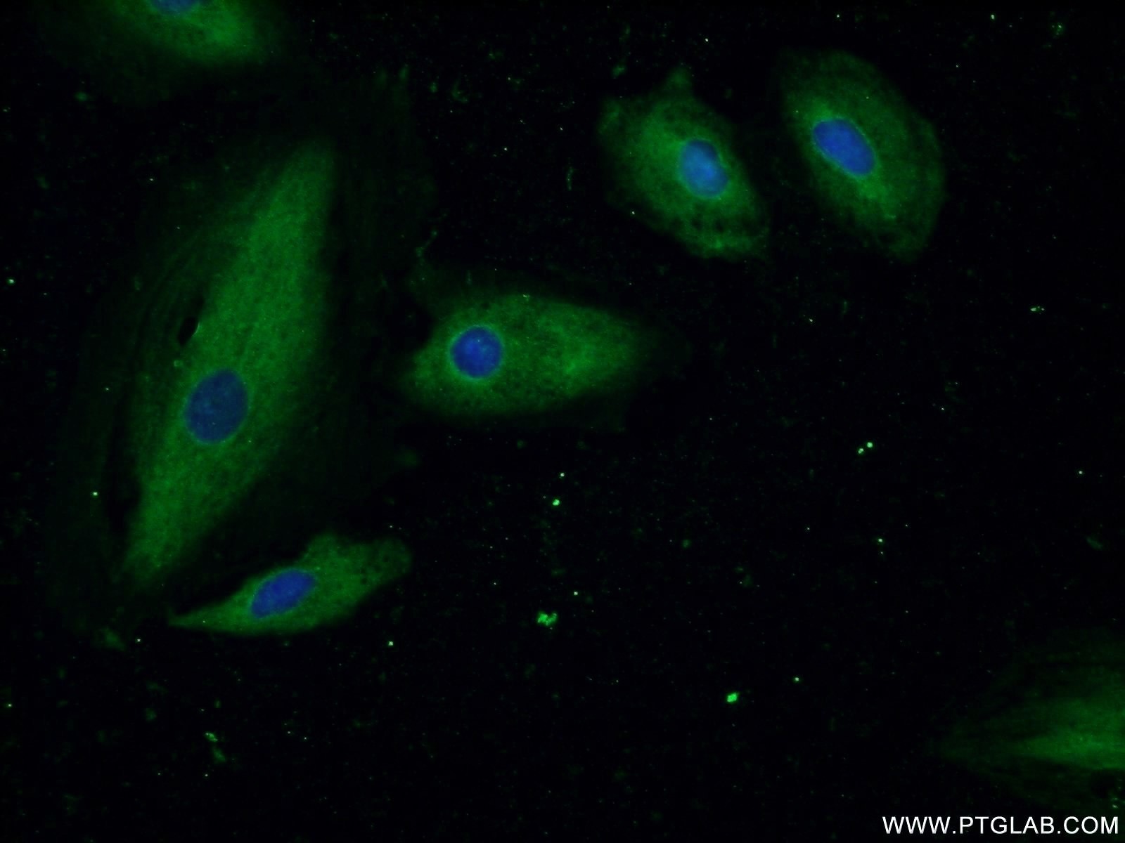 IF Staining of A549 using 14981-1-AP