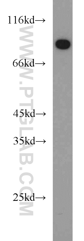 WB analysis of human testis using 14981-1-AP