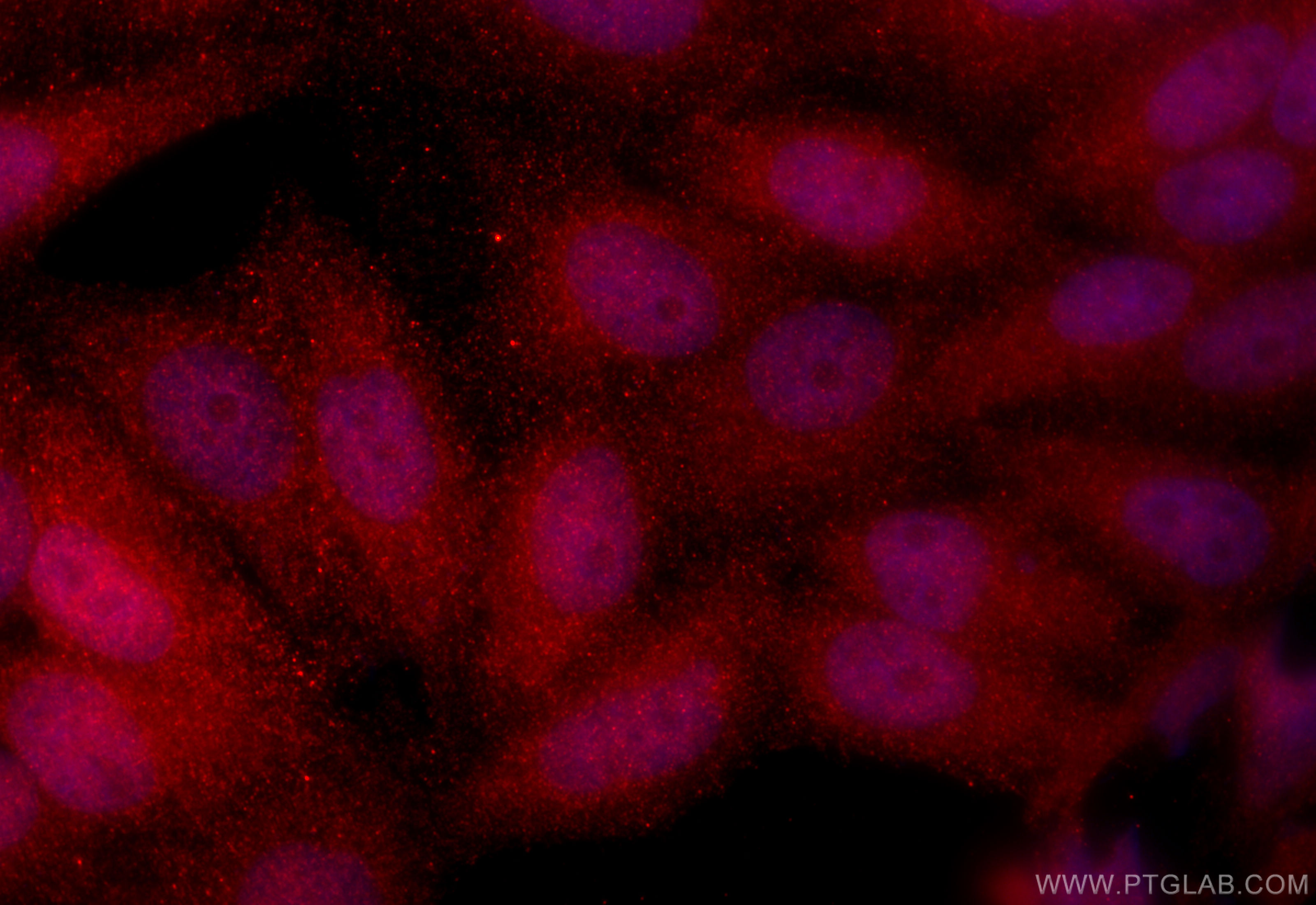 IF Staining of HepG2 using 15450-1-AP