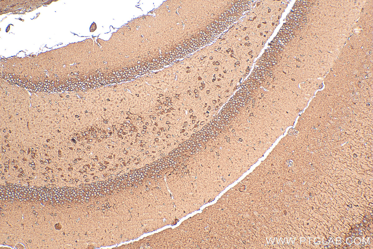 Immunohistochemical analysis of paraffin-embedded mouse brain tissue slide using 15450-1-AP (ASNA1 antibody) at dilution of 1:200 (under 10x lens). Heat mediated antigen retrieval with Tris-EDTA buffer (pH 9.0). IHC staining of mouse brain using 15450-1-AP