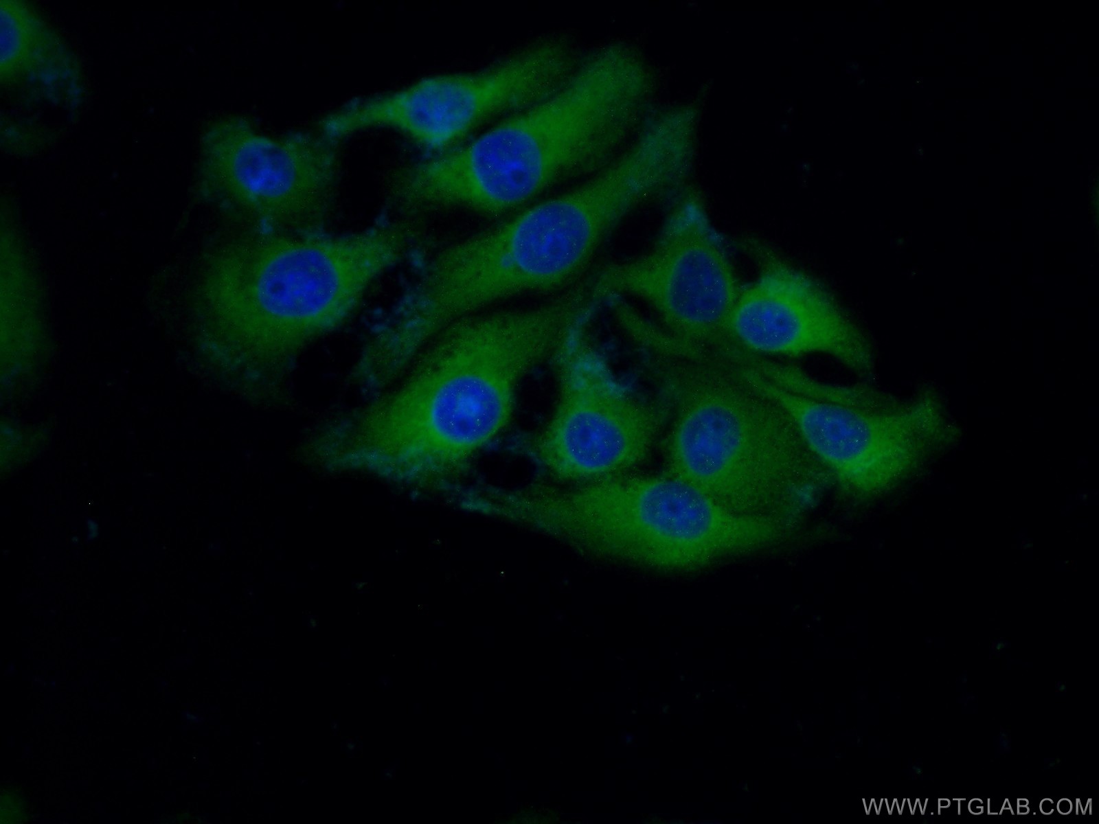 IF Staining of SH-SY5Y using 14681-1-AP
