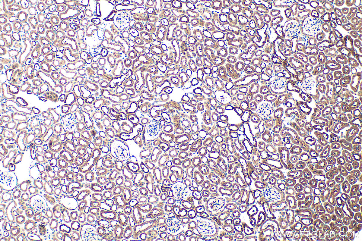 IHC staining of mouse kidney using 14681-1-AP