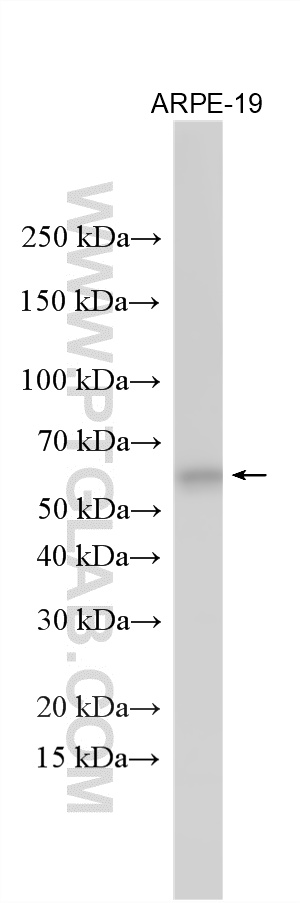 Various lysates were subjected to SDS PAGE followed by western blot with 14681-1-AP (ASNS antibody) at dilution of 1:5000 incubated at room temperature for 1.5 hours. WB analysis using 14681-1-AP