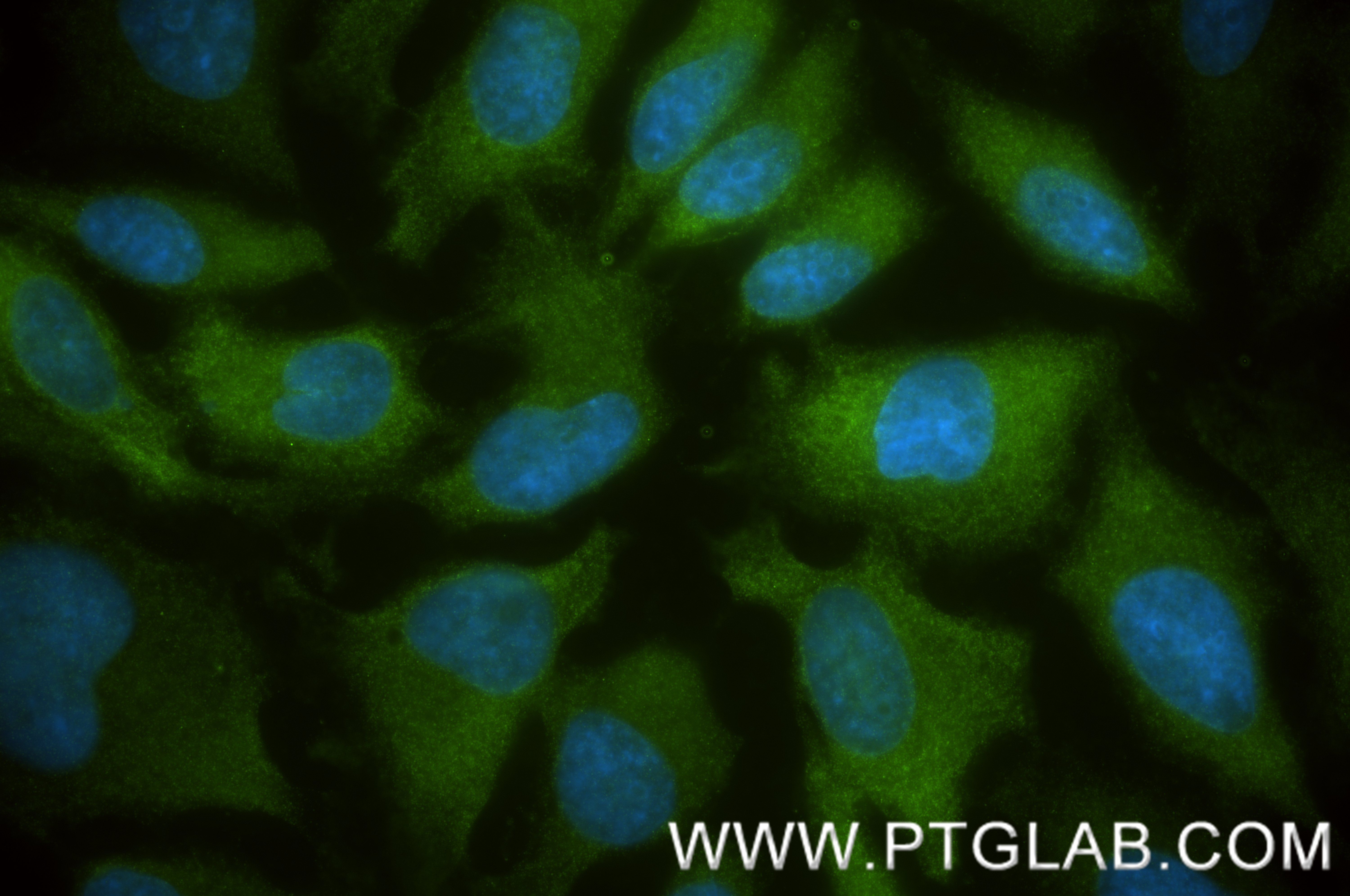IF Staining of HeLa using 85892-1-RR