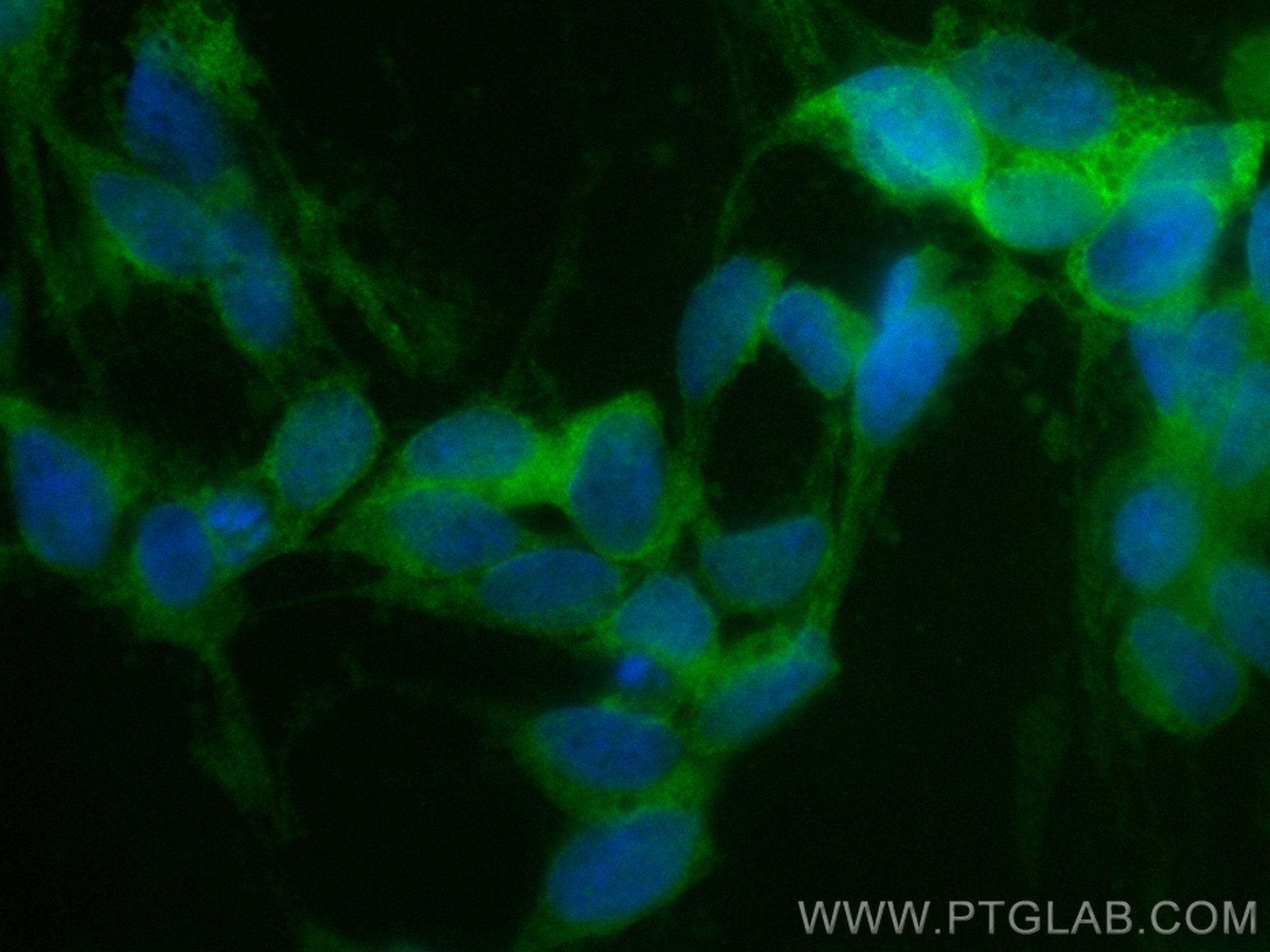 IF Staining of SH-SY5Y using CL488-14681