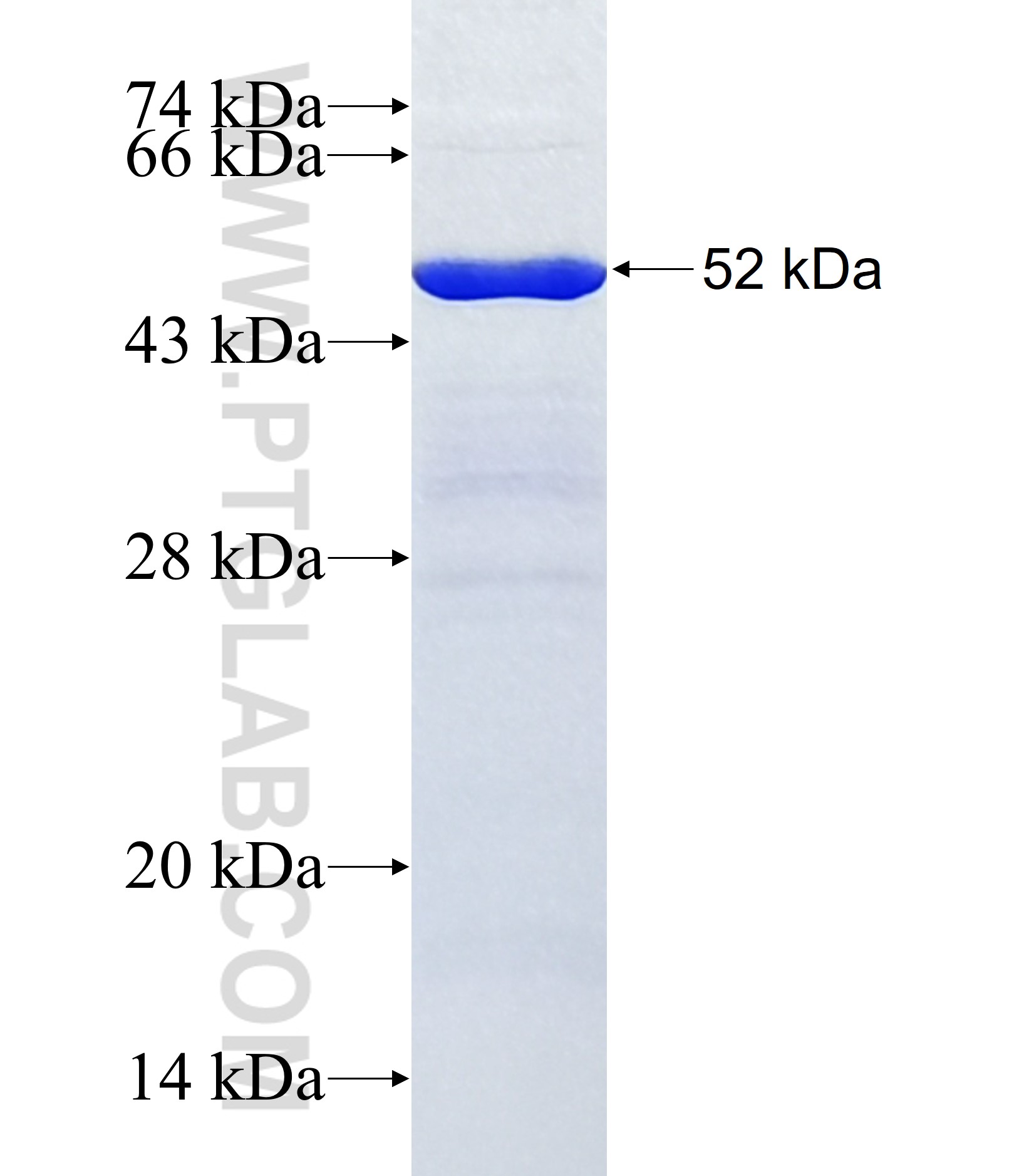 ASNSD1 fusion protein Ag37503 SDS-PAGE