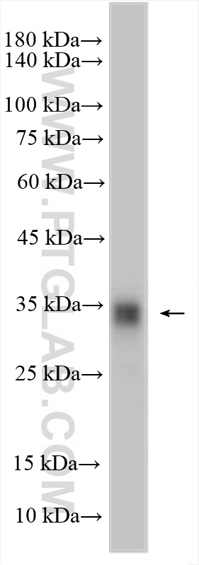 WB analysis of mouse brain using 13244-1-AP