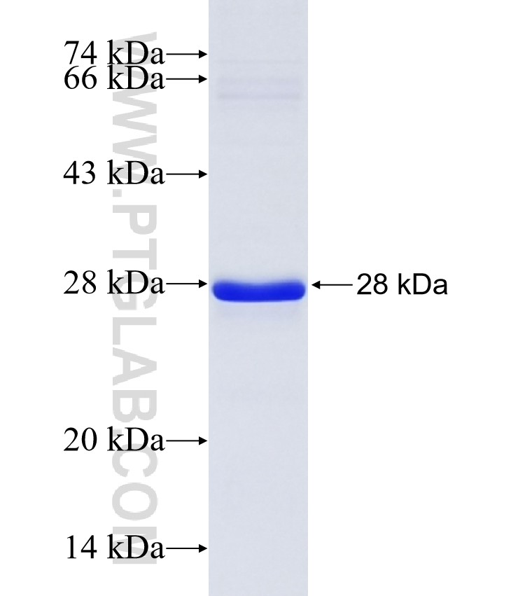 ASPG fusion protein Ag37309 SDS-PAGE ASPG fusion protein Ag37309 SDS-PAGE