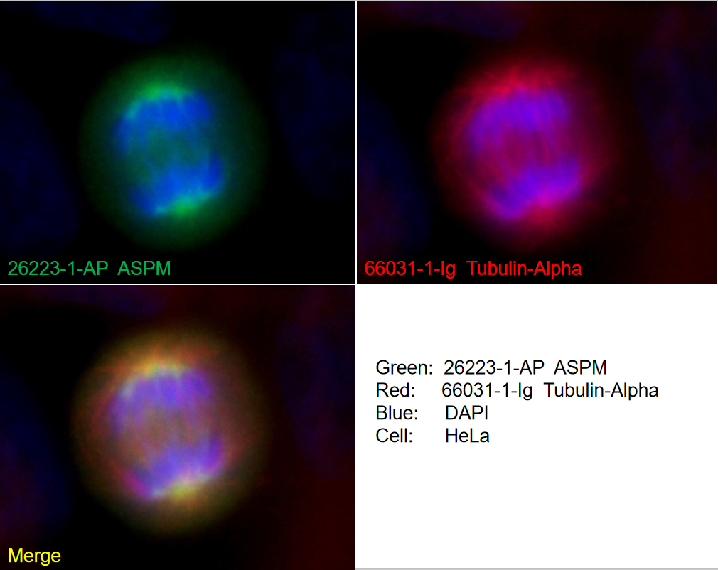 IF Staining of HeLa using 26223-1-AP