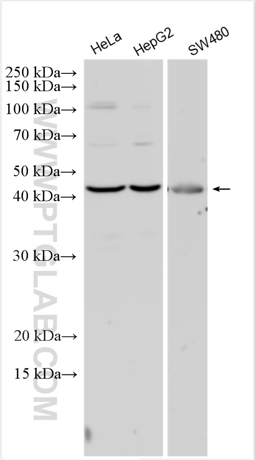 WB analysis using 27602-1-AP