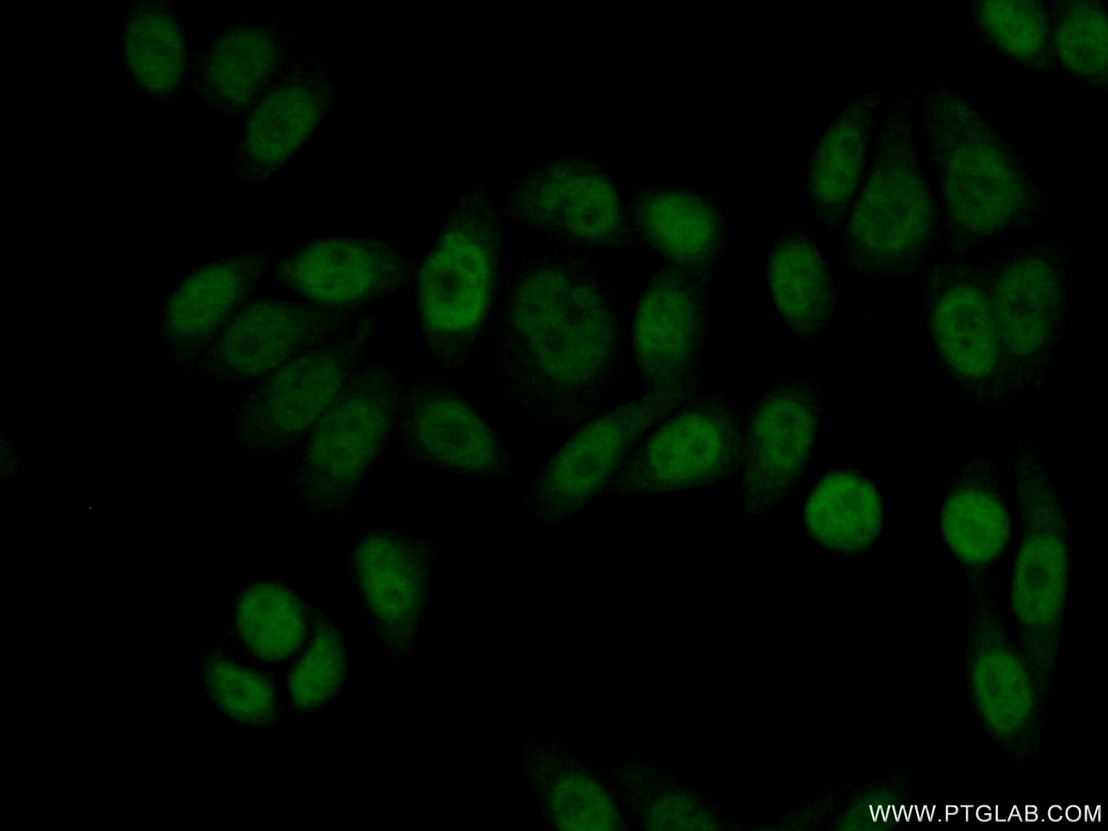 IF Staining of HeLa using 11400-1-AP