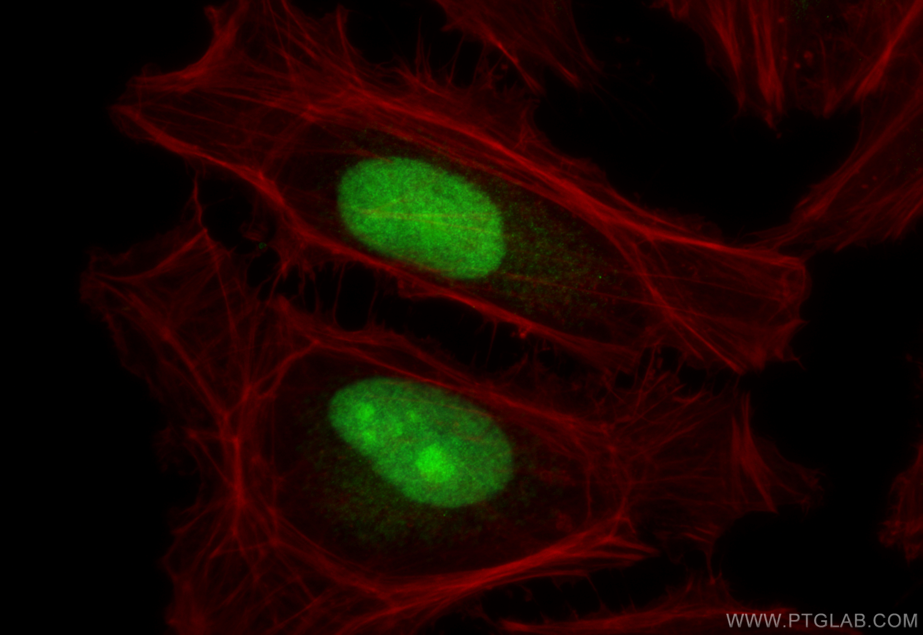 Immunofluorescent analysis of (4% PFA) fixed HeLa cells using ASRGL1 antibody (11400-1-AP) at dilution of 1:500 and CoraLite®488-Conjugated Goat Anti-Rabbit IgG(H+L) (<a class='green' href='/productredirect?CatalogNo=SA00013-2' target='_blank'>SA00013-2</a>), CL594-Phalloidin (red). IF Staining of HeLa using 11400-1-AP