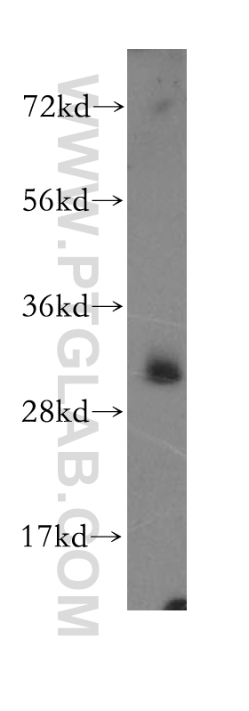 WB analysis of HeLa using 11400-1-AP