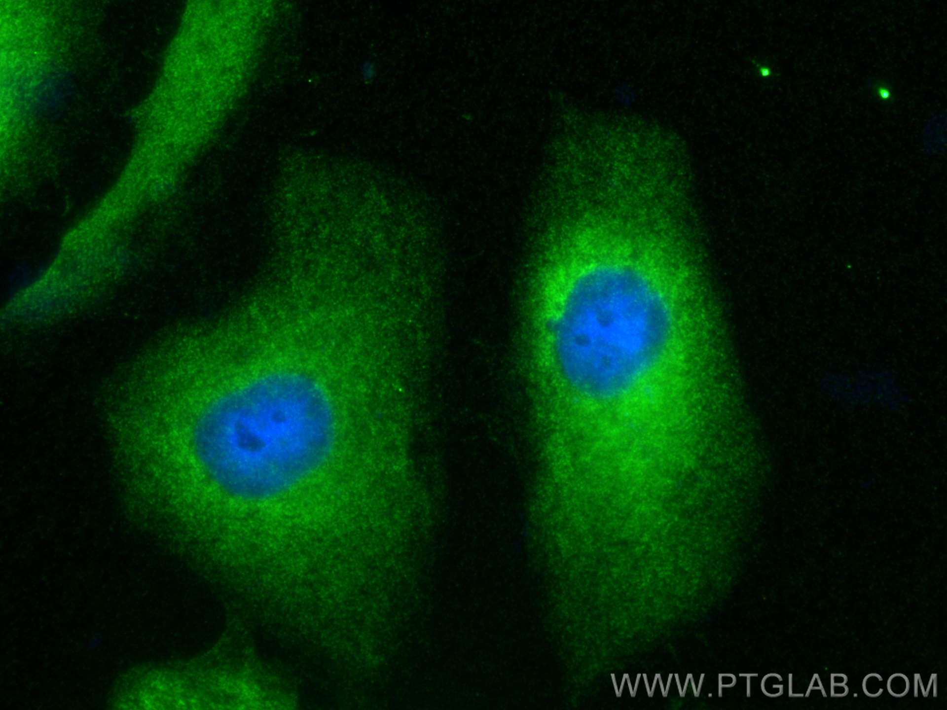 IF Staining of HeLa using 16210-1-AP