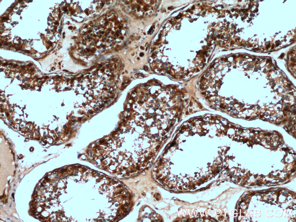 IHC staining of human testis using 16210-1-AP