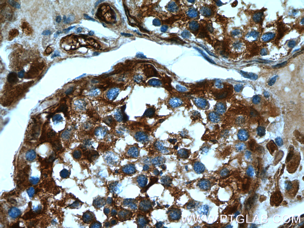 IHC staining of human testis using 16210-1-AP