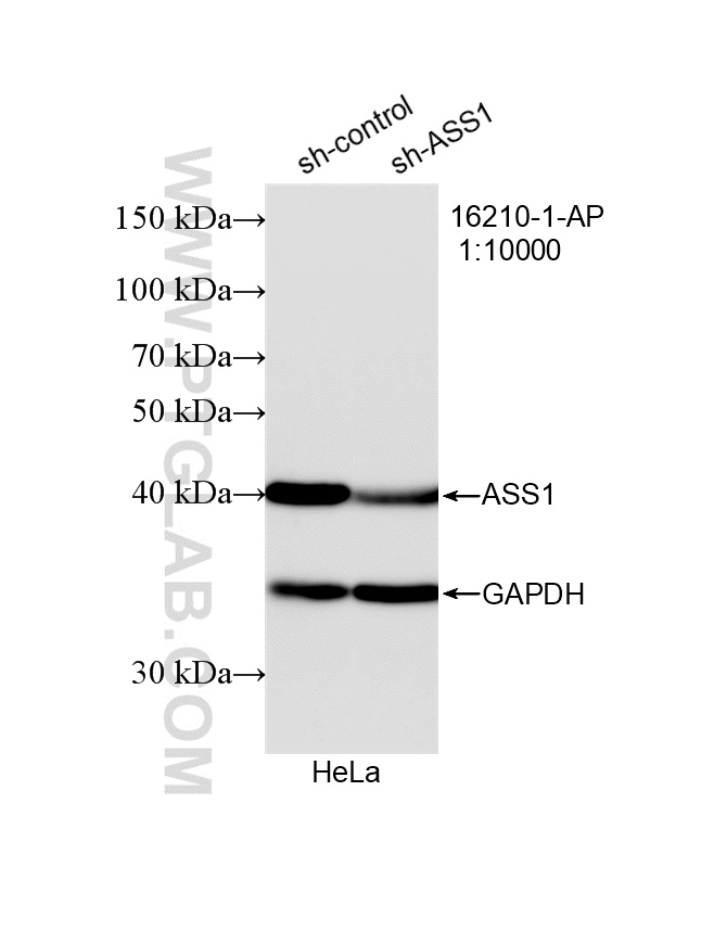 WB analysis of HeLa using 16210-1-AP