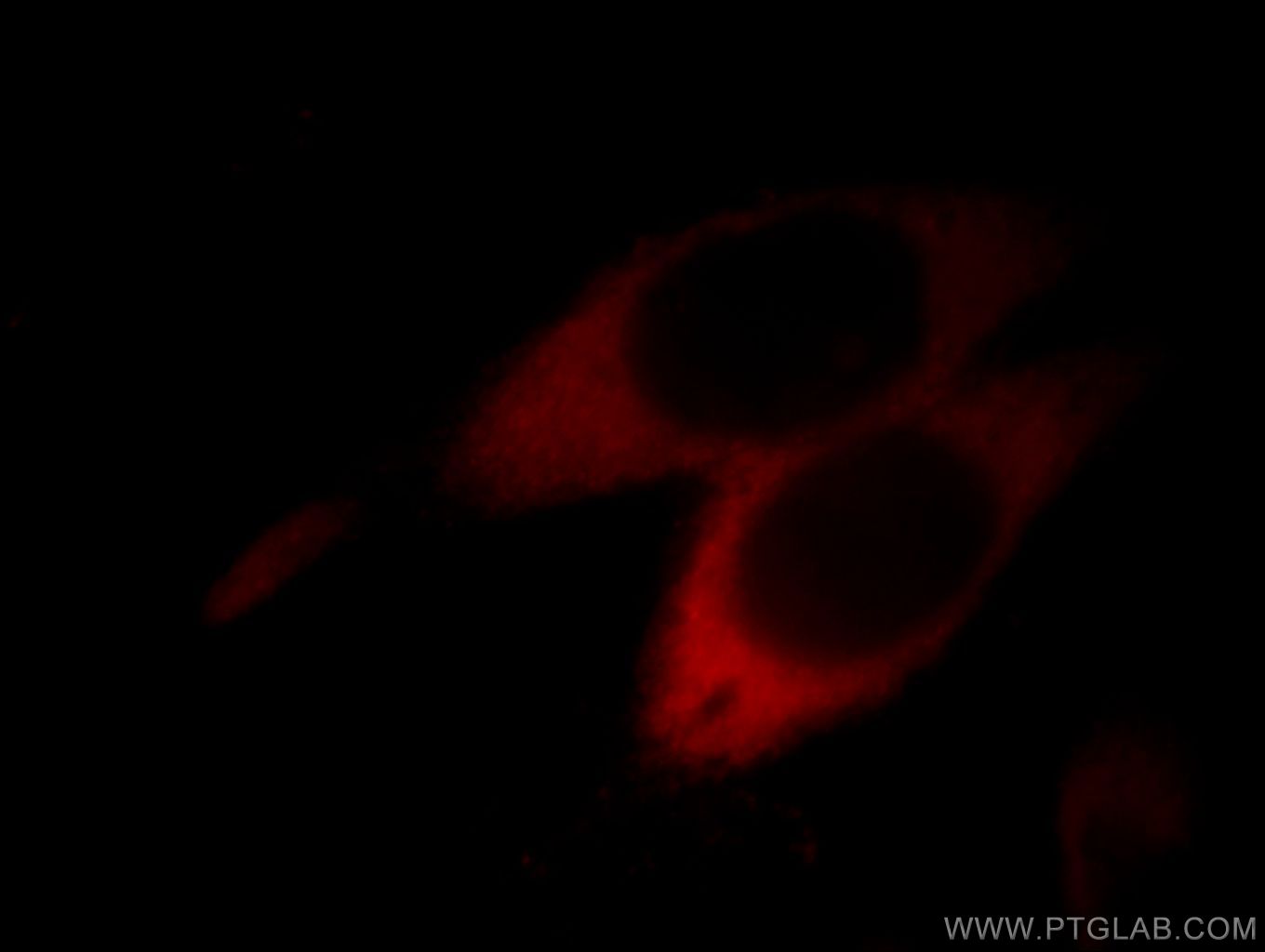 IF Staining of MCF-7 using 66036-1-Ig (same clone as 66036-1-PBS)