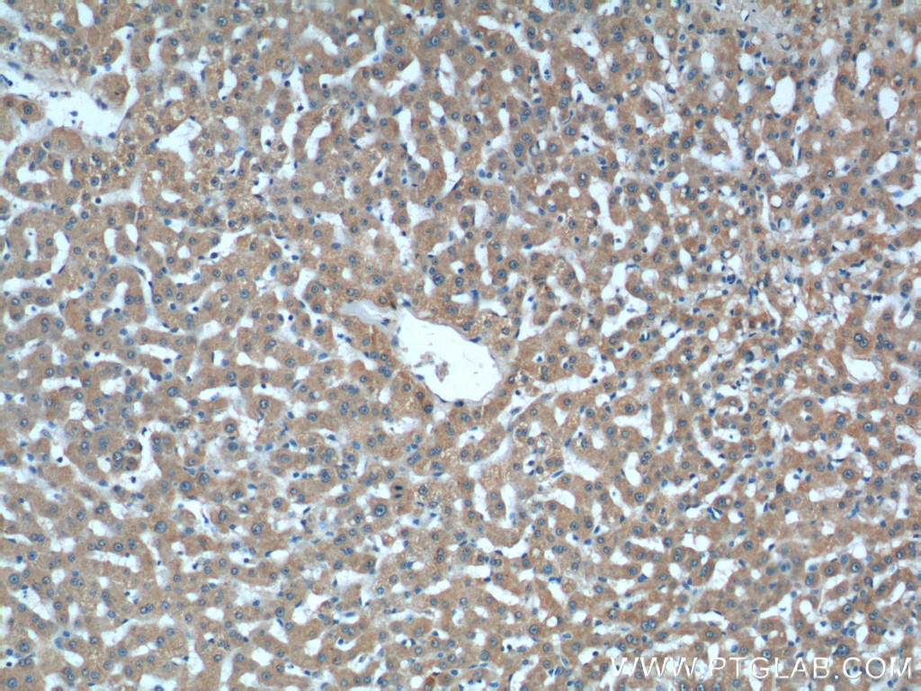 IHC staining of human liver using 66036-1-Ig (same clone as 66036-1-PBS)