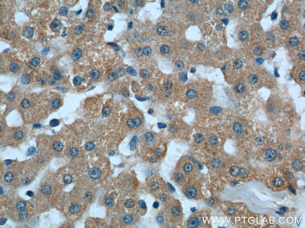 IHC staining of human liver using 66036-1-Ig (same clone as 66036-1-PBS)