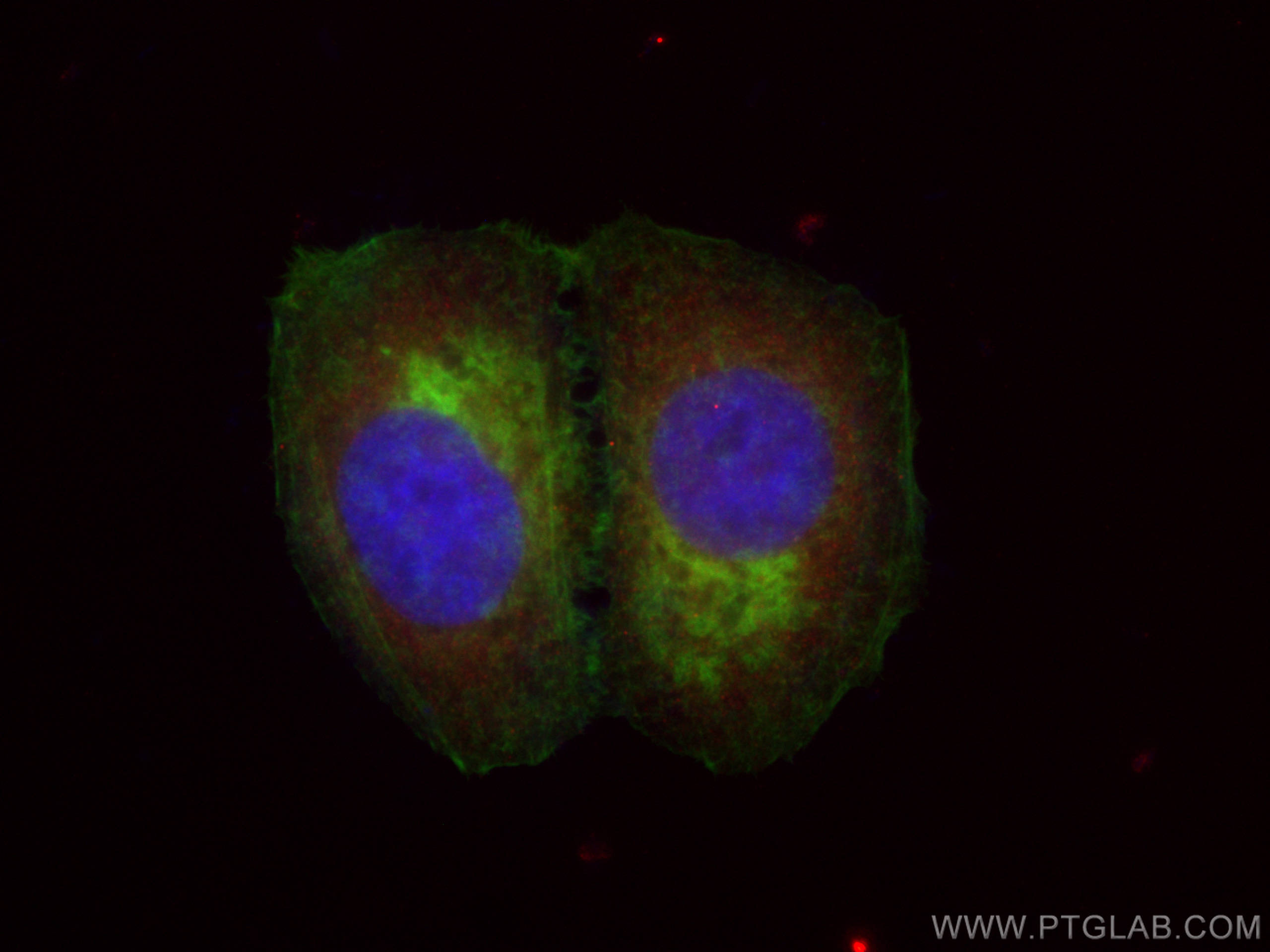 IF Staining of MCF-7 using CL594-66036