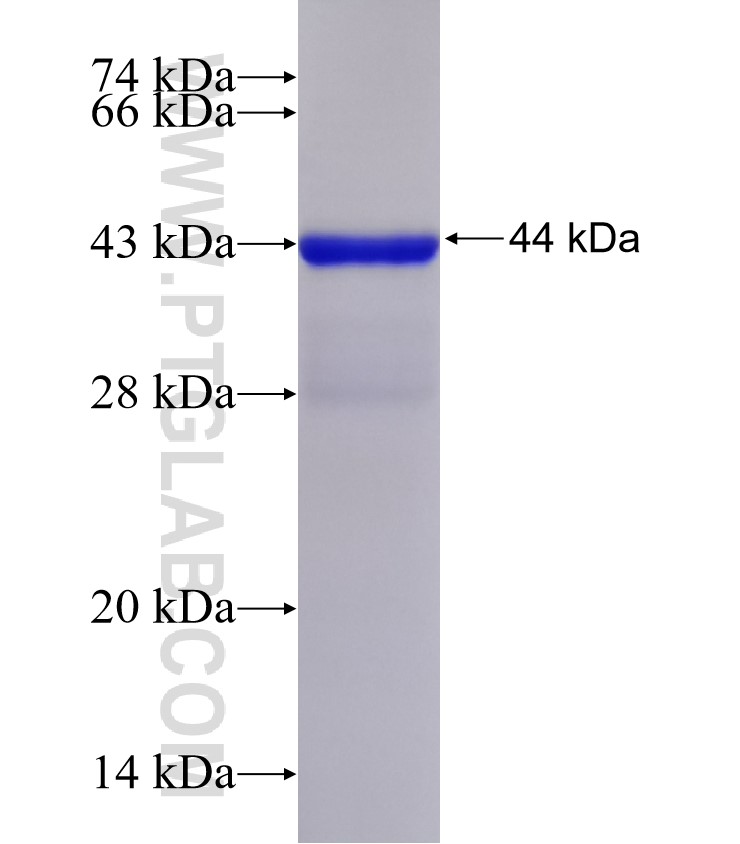 ASTE1 fusion protein Ag32339 SDS-PAGE ASTE1 fusion protein Ag32339 SDS-PAGE