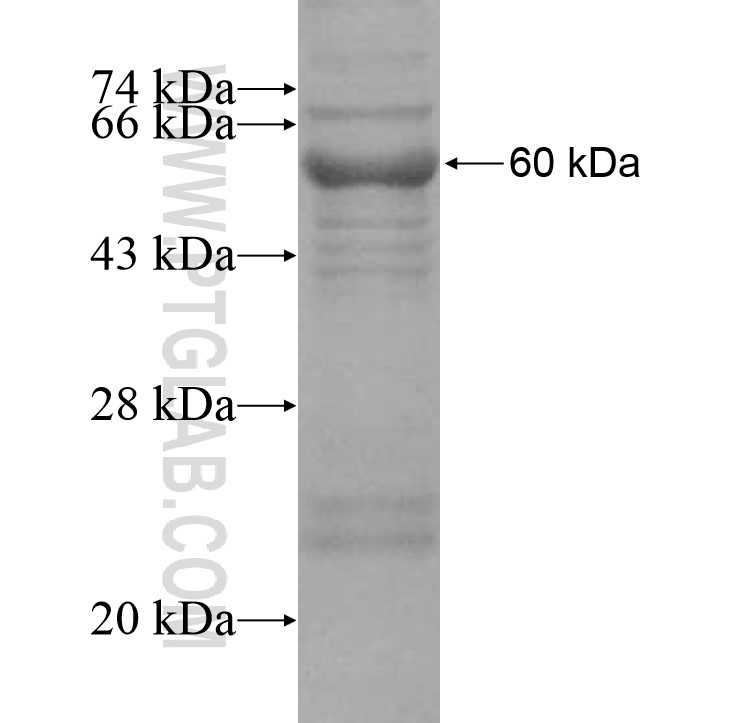 ASTL fusion protein Ag15997 SDS-PAGE