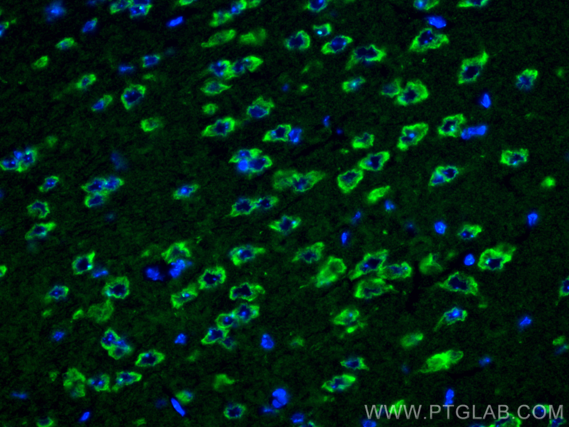 Immunofluorescent analysis of (4% PFA) fixed paraffin-embedded mouse brain tissue using ASTN1 antibody (21267-1-AP) at dilution of 1:400 and CoraLite®488-Conjugated Goat Anti-Rabbit IgG(H+L) (<a class='green' href='/productredirect?CatalogNo=SA00013-2' target='_blank'>SA00013-2</a>). Heat mediated antigen retrieval with Tris-EDTA buffer (pH 9.0). IF Staining of mouse brain using 21267-1-AP