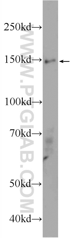 WB analysis of HepG2 using 17351-1-AP