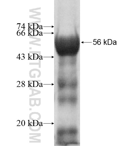 ASTN2 fusion protein Ag11409 SDS-PAGE ASTN2 fusion protein Ag11409 SDS-PAGE