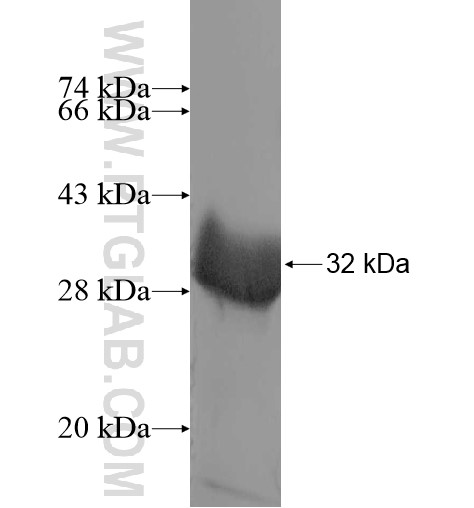 ASXL1 fusion protein Ag10290 SDS-PAGE
