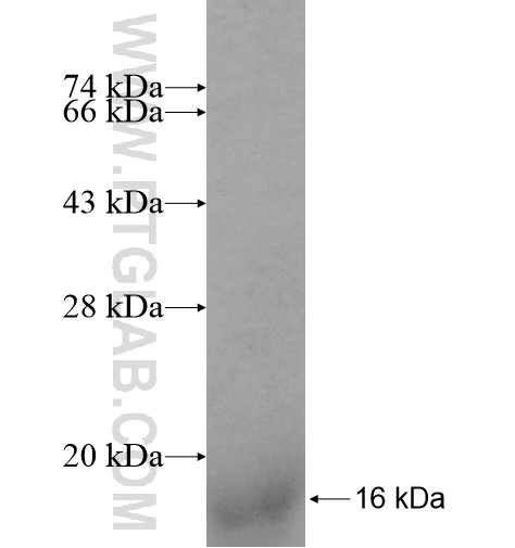 ASXL1 fusion protein Ag10305 SDS-PAGE ASXL1 fusion protein Ag10305 SDS-PAGE