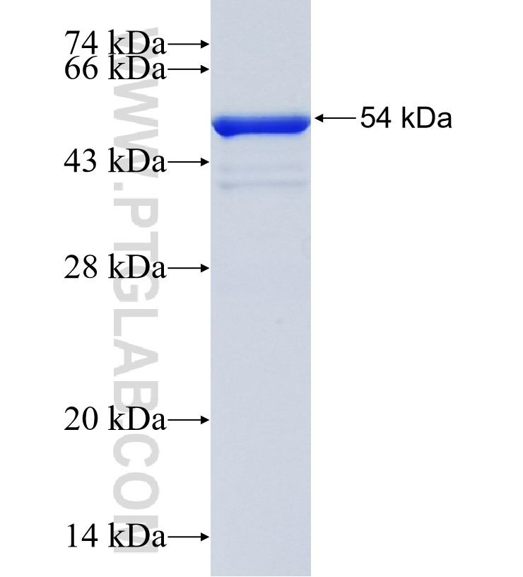 ASXL3 fusion protein Ag34634 SDS-PAGE ASXL3 fusion protein Ag34634 SDS-PAGE