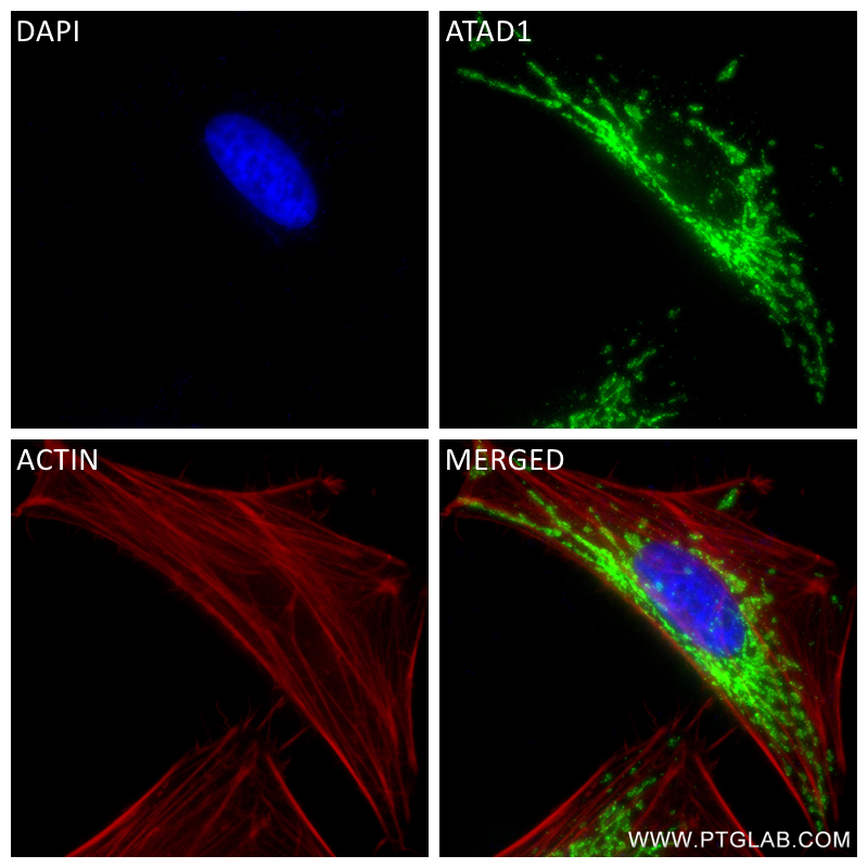 IF Staining of HeLa using 84194-6-RR (same clone as 84194-6-PBS)