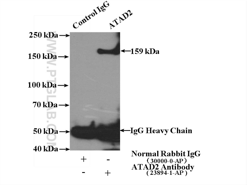 IP experiment of HeLa using 23894-1-AP