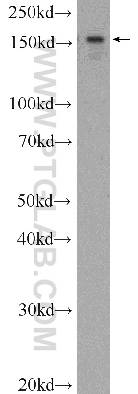 WB analysis of HeLa using 23894-1-AP