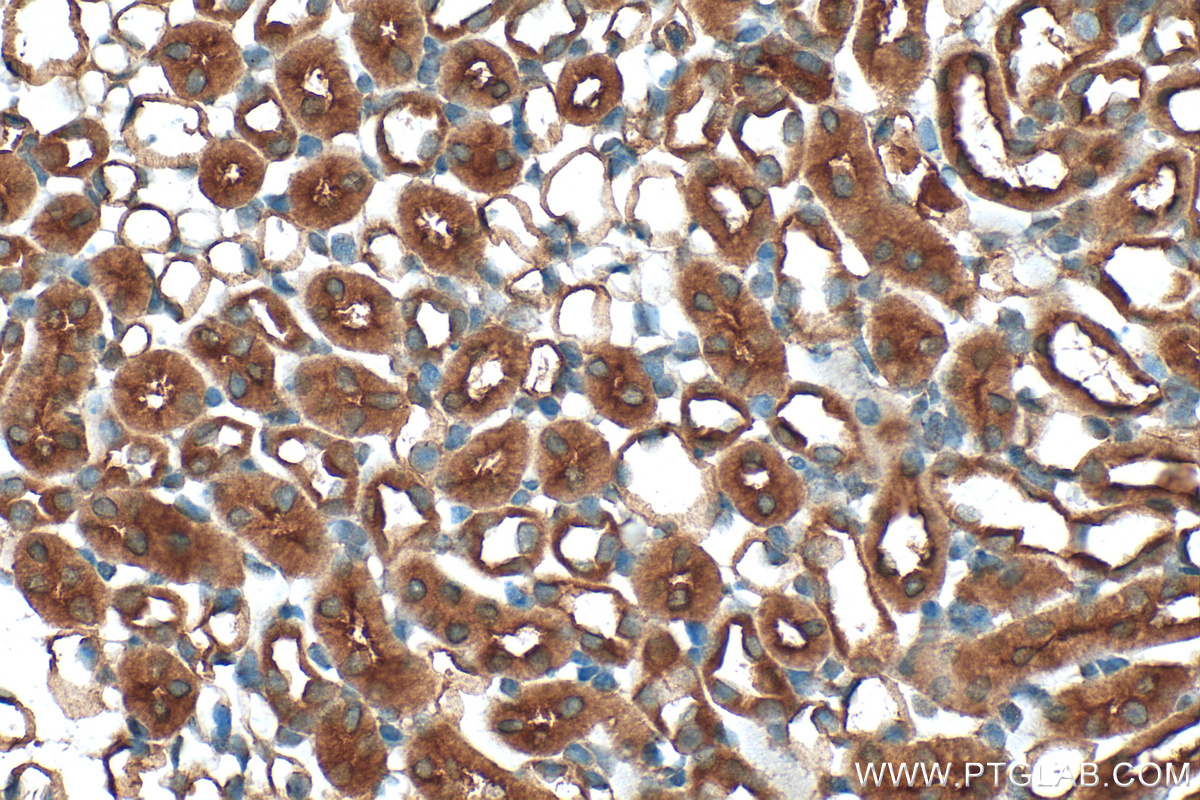 IHC staining of mouse kidney using 25693-1-AP