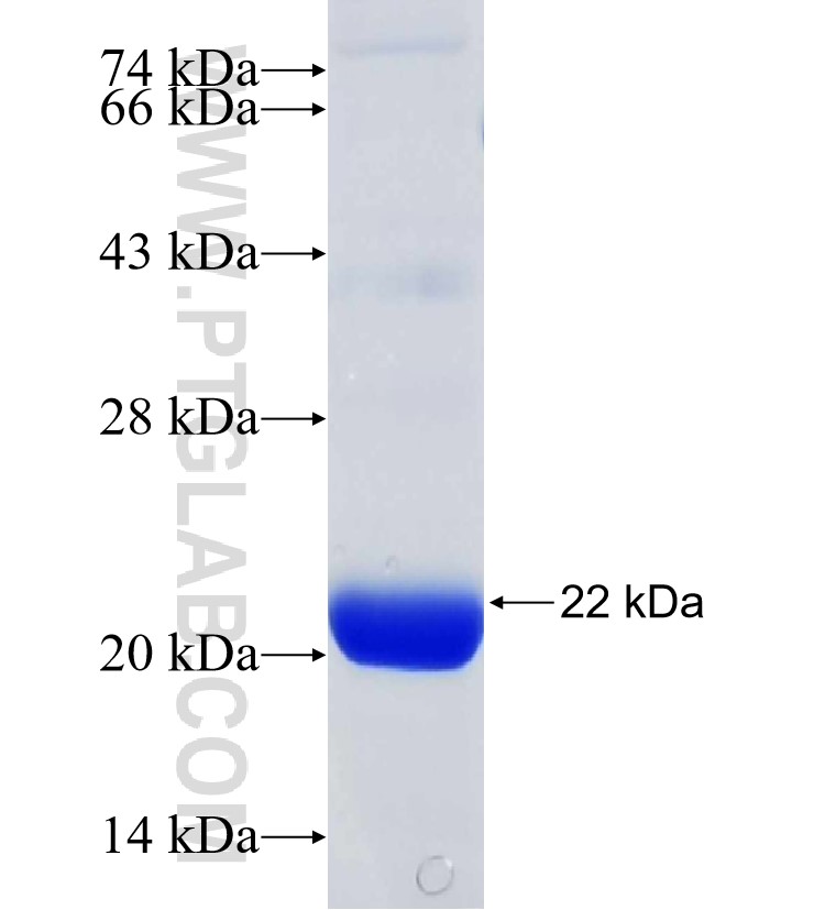 ATAT1 fusion protein Ag31018 SDS-PAGE